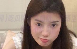 吃瓜网点亮朝阳，链接里的柔情蜜意不常见！